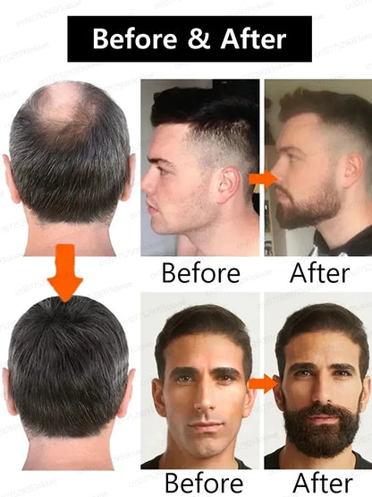 Unisex Hair Growth Serum For Beard, Hair And Body