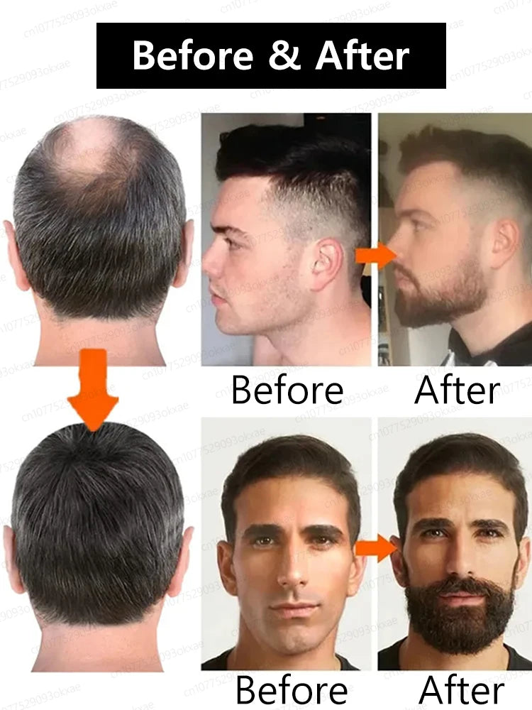 Unisex Hair Growth Serum For Beard, Hair And Body